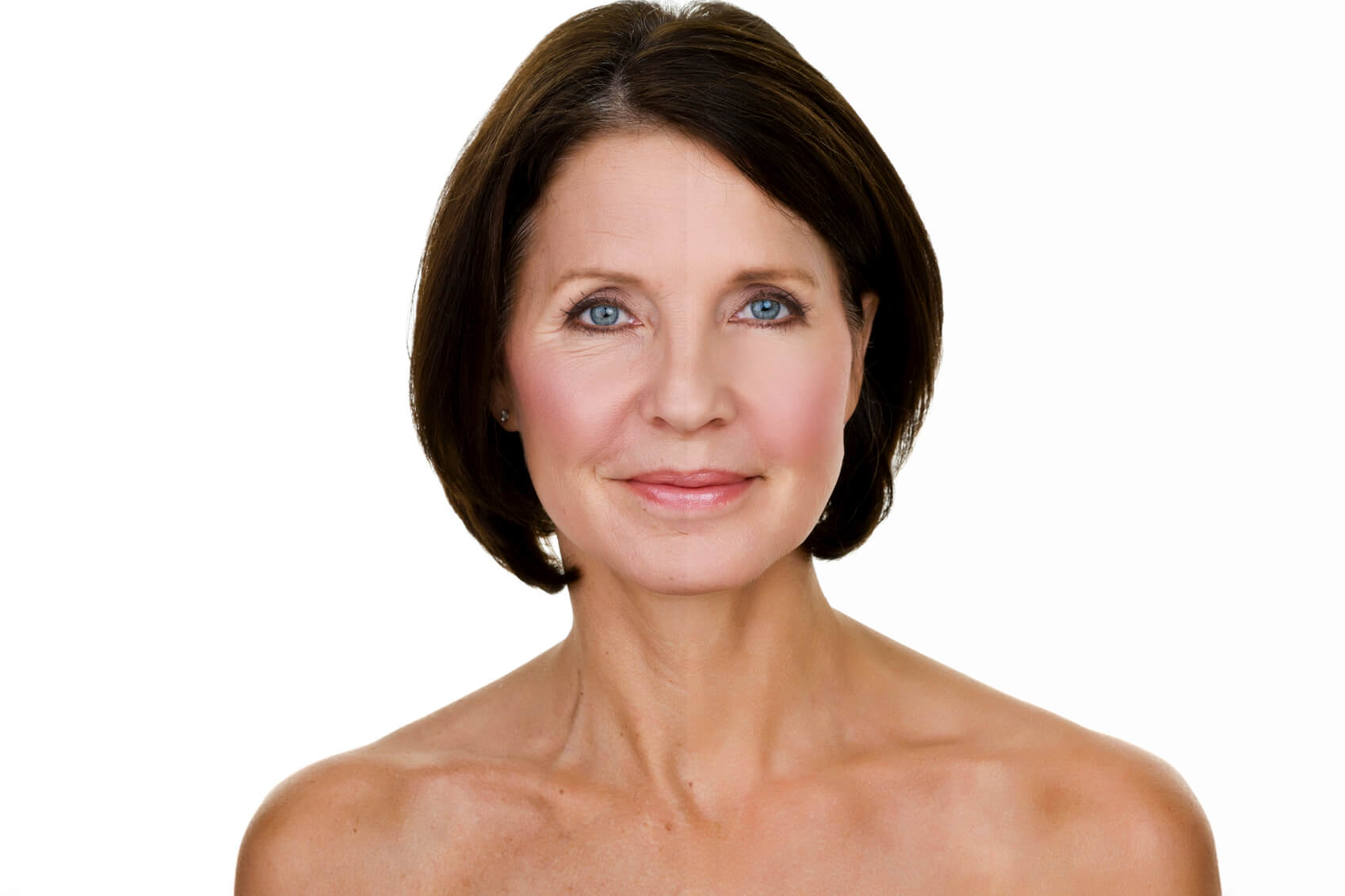 As you age, you develop wrinkles and creases on your face. 